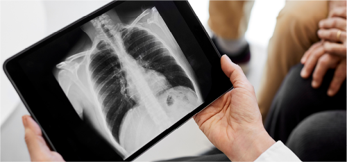 Zinc reverses lung damage and dramatically improves patient survival