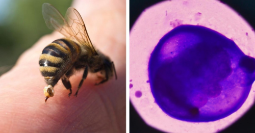 New research reveals that honeybee venom can cure breast cancer
