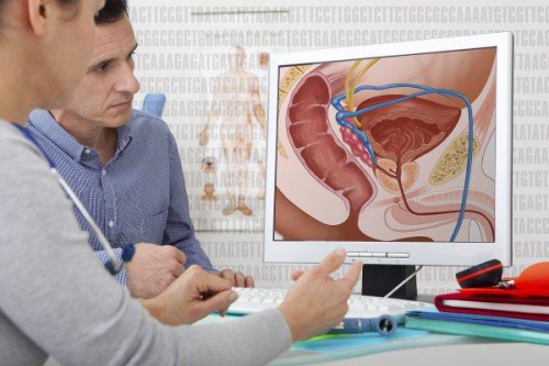 Game-changing surgery can cure prostate cancer in one hour