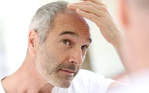 MicroRNA will regrow 90% of lost hair, study finds