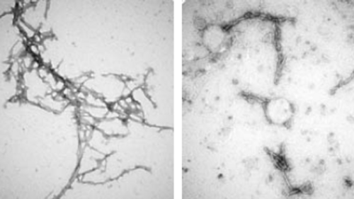 Scientists create tough nanobodies to treat Dementia and Parkinson’s Disease
