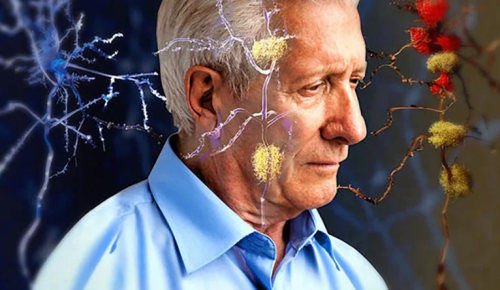 Lifechanging study reveals the cause of Alzheimer’s disease and dementia