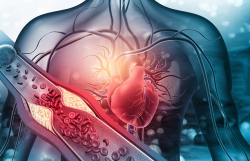 Groundbreaking heart disease treatment uses ultrasound-assisted lasers