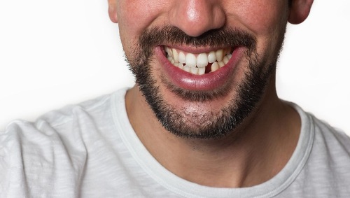 Revolutionary new drug regrows teeth - now in clinical trials