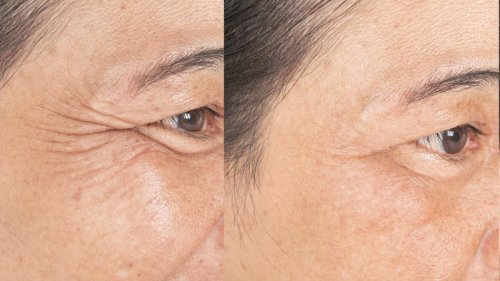 This Viral Skincare Product Magically Erases Puffiness and Wrinkles in Minutes (and Lasts 6-8 Hours)