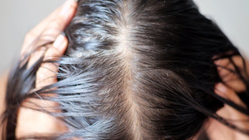 Eating Too Much of This Type of Food May Cause Hair Loss