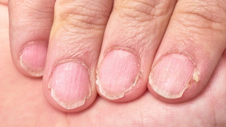 Improve Your Nail Health With These Tips - cover