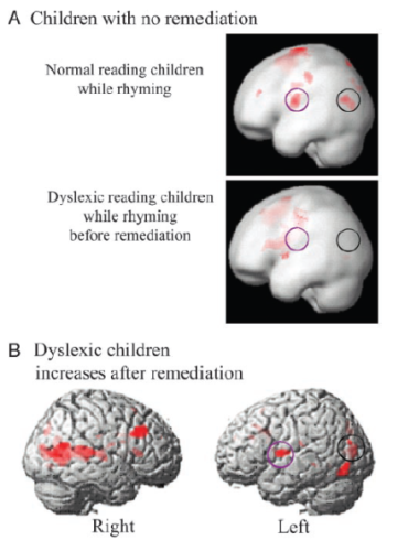 Neuroeducación: estrategias basadas en el funcionamiento del cerebro