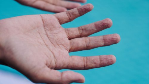 Wet fingers always wrinkle in the same way