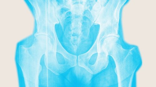 Don’t wait until menopause to strengthen your bones