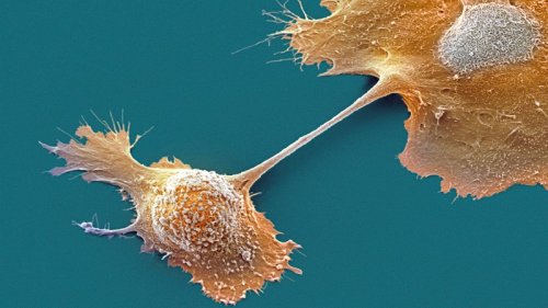 An mRNA cancer vaccine may offer long-term protection