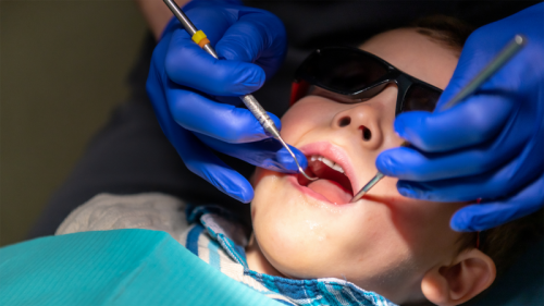 Two cities stopped adding fluoride to water. Science reveals what happened