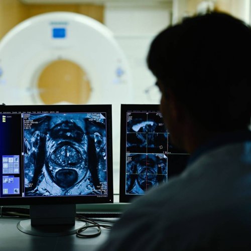 Gesundheit: Prostatakrebs: Was Männer wissen sollten