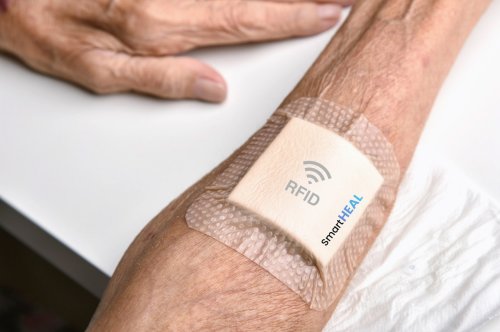 SmartHEAL sensor tells you if wound may be infected using RFID
