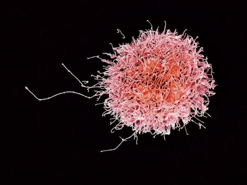 Células diseñadas para destruir los tumores malignos sin atacar al resto de células