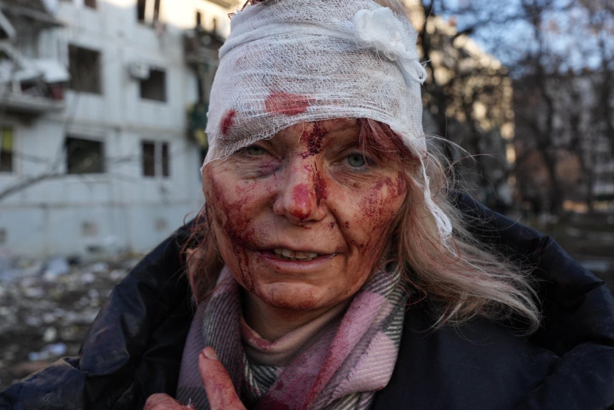 Ukrainian woman who became bloodied face of war: 'I never thought this would happen in my lifetime.'