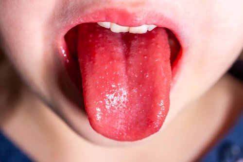 Doctors urge Leeds parents to look out for these symptoms of Strep A infection