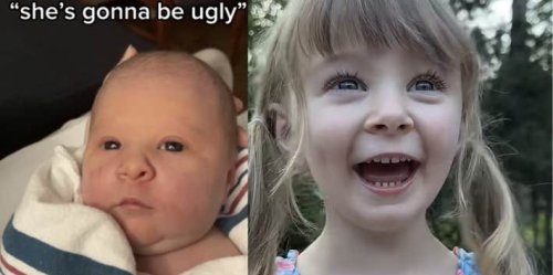 Mom Posts Her 'Ugly' Newborn's Glow Up & Gets Called Out By Parents