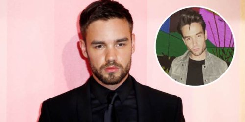 Liam Payne's Possible Cosmetic Surgery Shows That Men Aren't Immune To ...