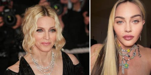 Why Can’t An Iconic Rebel Like Madonna Embrace Aging?