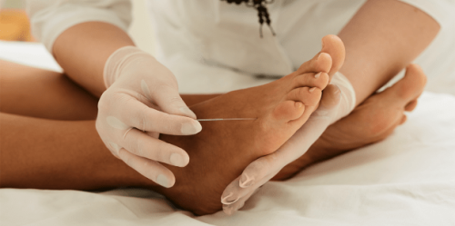 The Strange Cure For The Chronic Foot Pain That Was Ruining My Life