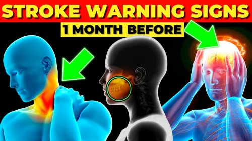 7 Stroke Symptoms 1 month before it happens (Detect it Quickly)