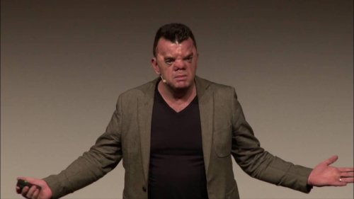 Own your face | Robert Hoge | TEDxSouthBank