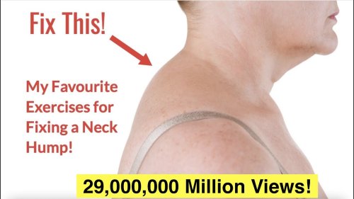 How to Fix a Neck Hump at Home (FAST) | With FREE Exercise Sheet!