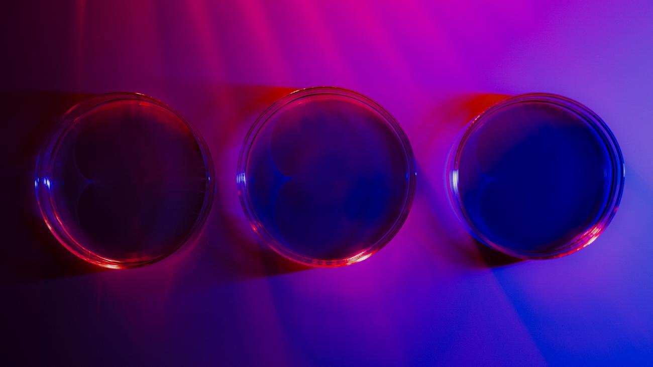 Spiegelbakterien: "Haben wir recht, sprechen wir über das Ende des Lebens auf der Erde"