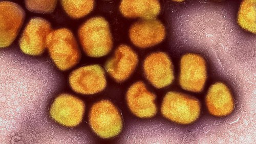 Infektionskrankheit: Berlin meldet zehn Mpox-Infektionen innerhalb einer Woche
