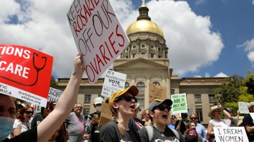 Schwangerschaftsabbrüche in den USA: Hirntote Schwangere wird wegen strenger US-Gesetze künstlich beatmet