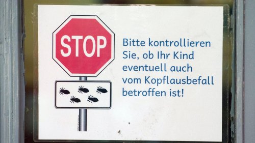 Gesundheit: Kopfläuse im Winter - Darum steigen die Zahlen