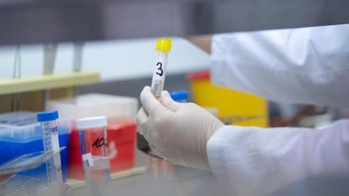 Gesundheit: Zahl der Corona-Infizierten steigt weiter