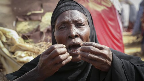Lagebericht der UN: Der Hunger in der Welt hat stark zugenommen