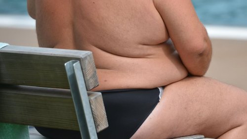 Krankheiten: Übergewicht steigert Krebsrisiko - mehr Prävention gefordert
