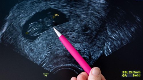 Frauengesundheit: Hessen will Frauen auch gesundheitlich gleichstellen