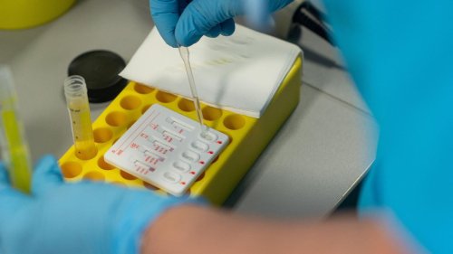Gesundheit: Schadstoffe im Urin von Kindern rückläufig
