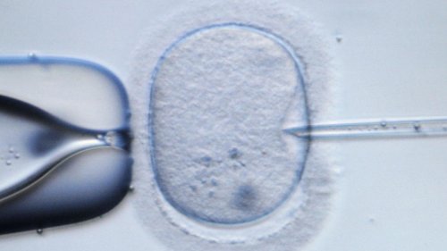 Persönlichkeitsrechte für Embryos: Universität von Alabama stoppt nach Gerichtsurteil In-vitro-Programm
