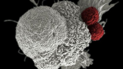 Cancer Breakthrough: Scientists Discover Tumor Stopper That Keeps Cells From Spreading - Zenger News