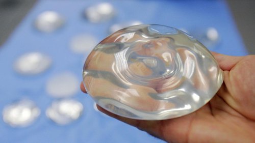 Cancer Link Sparks Breast Implant Alert In Australia's Victoria - Zenger News