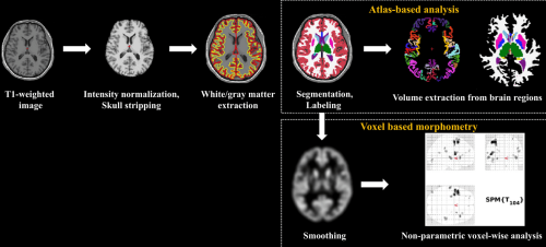 Working overtime may be reshaping your brain